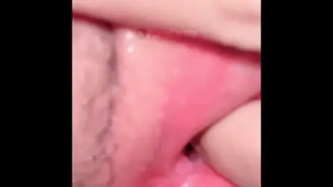 DILA TIKTOK TOBRUT BAIK X(1)